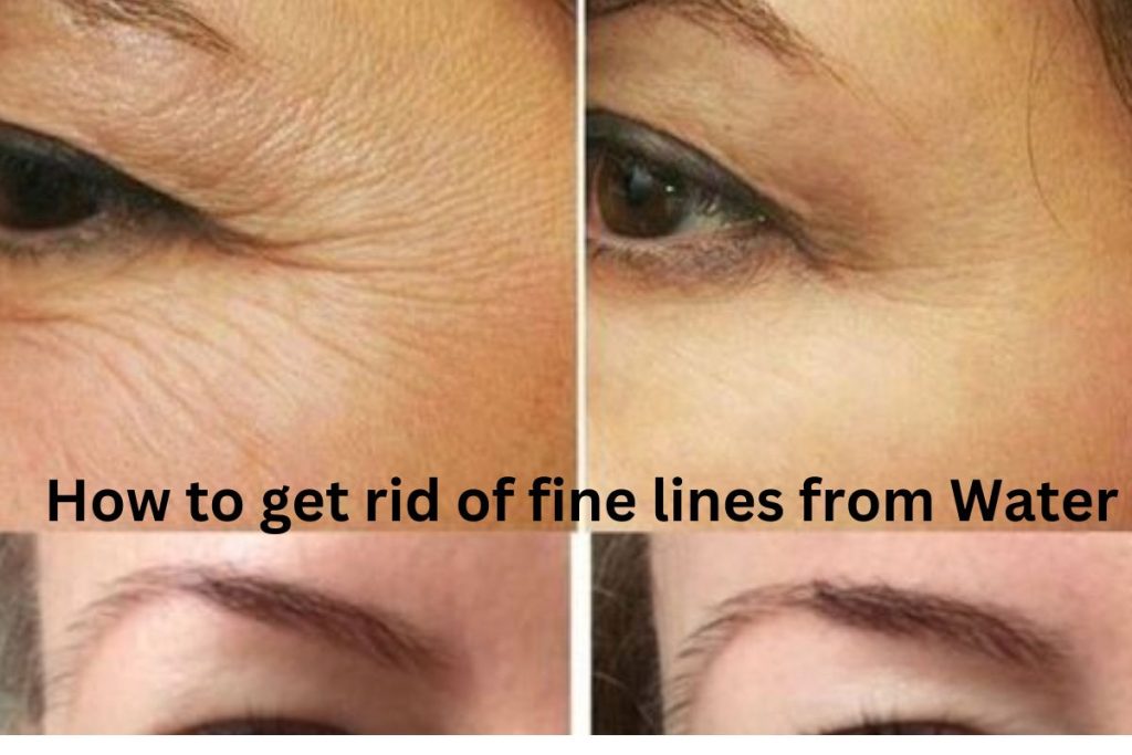 Skin hydration