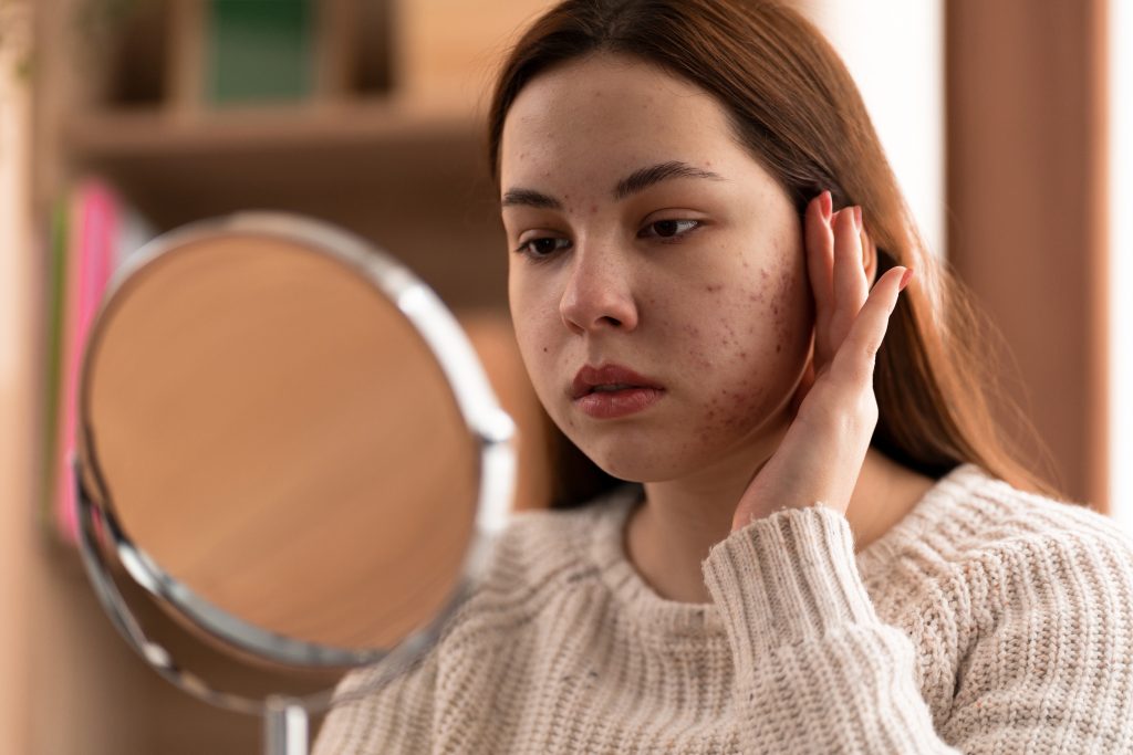 3 Best Potato Dark Spot Remedies to Fade Dark Spots Naturally